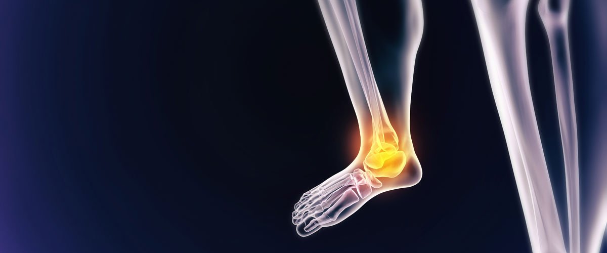 osteoporose_web.jpg